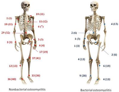 Nonbacterial and bacterial osteomyelitis in children: a case–control retrospective study